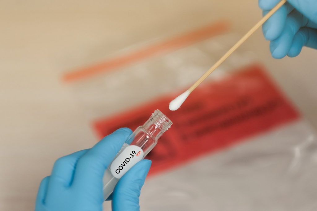 covid-testas-covid-19-testas-koronaviruso-testas-86270407